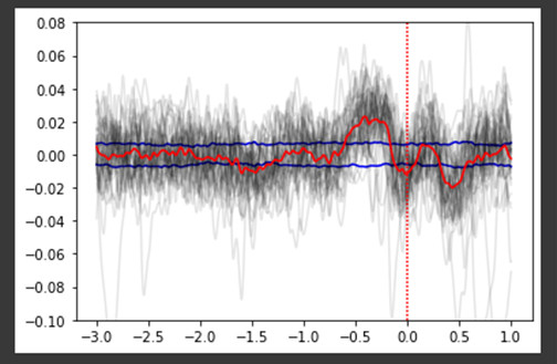 EEG signal that looks like readiness potential