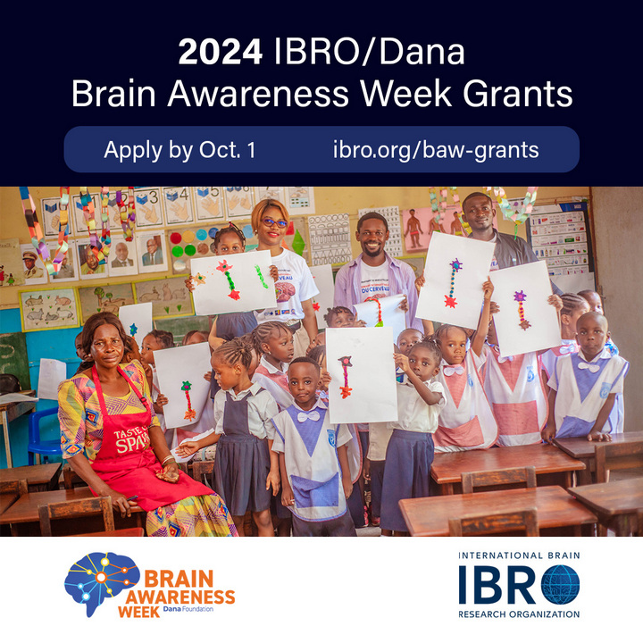 5 Brain Awareness Week Ideas (Apply Now to Get up to $1,250 in Grants!)